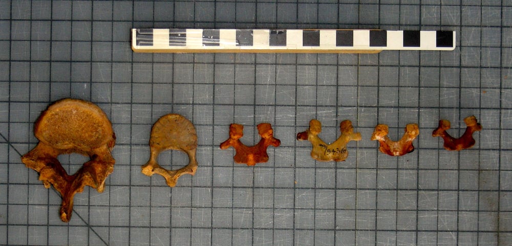 Age sequence (adult to infant, left to right) of human, first lumbar vertebrae