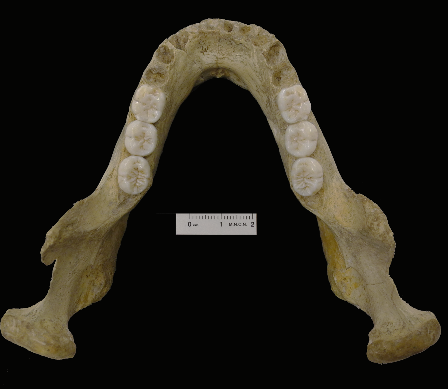 Mandible