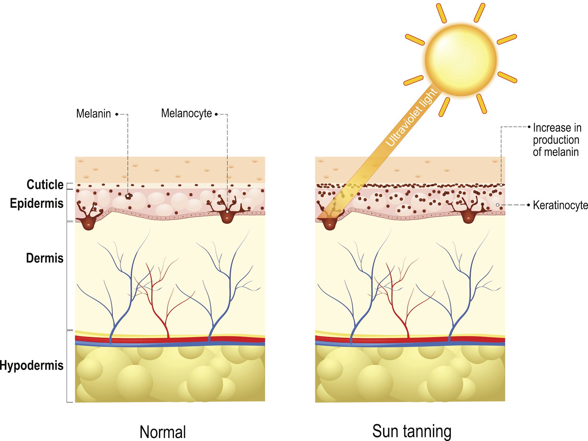 cross-sectional diagram of skin's layers with sunlight hitting the surface and showing increased production of melanin